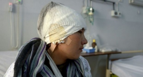 Zarina, une Afghane de 23 ans, qui a eu les deux oreilles coupées par son mari, est soignée à l'hôpital de Mazar-i-Sharif, le 2 février 2017 