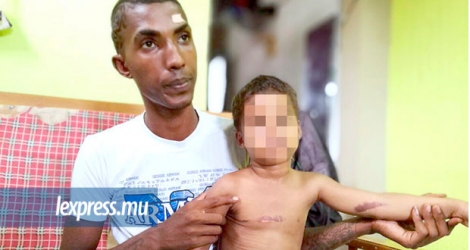 Ce père, consterné de voir des brûlures sur le corps de son fils, a dénoncé sa mère à la police, jeudi.