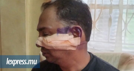  C’est en allant rendre visite à son épouse à l’hôpital que le père a été agressé. Il a été blessé au visage et au cou.