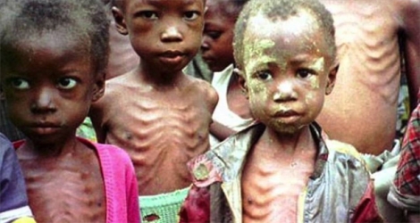 Quelque 155 millions d’enfants âgés de moins de 5 ans souffrent de malnutrition, selon la Food and Agriculture Organization.