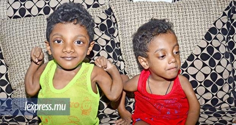 Waheed (à g.) et Aaliyan, dans les bras de leur mère, Fulzana Jules, souffrent de la maladie des os de verre.