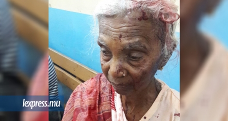 Indraotee Gokool, 75 ans, a été rouée de coups par une proche.