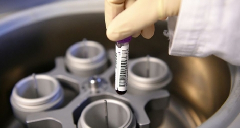 Un échantillon sanguin sur le point d'être testé au laboratoire national anti-dopage français de Chatenay-Malabry, près de Paris, le 15 décembre 2015.