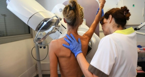 Mammographie réalisée sur une patiente, afin de dépister un éventuel cancer du sein.