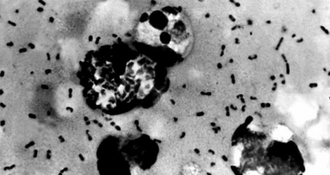 La bactérie Yersinia pestis peut être transmise à l'homme par des puces ayant mordu un rat déjà infecté.