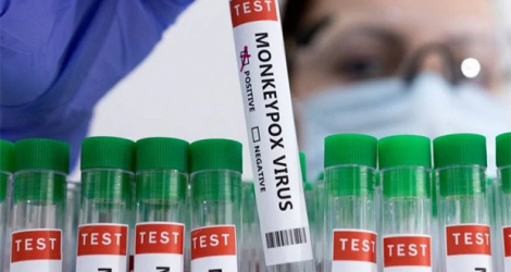 Les Emirats sont le deuxième pays du Moyen-Orient à annoncer un cas de variole du singe.