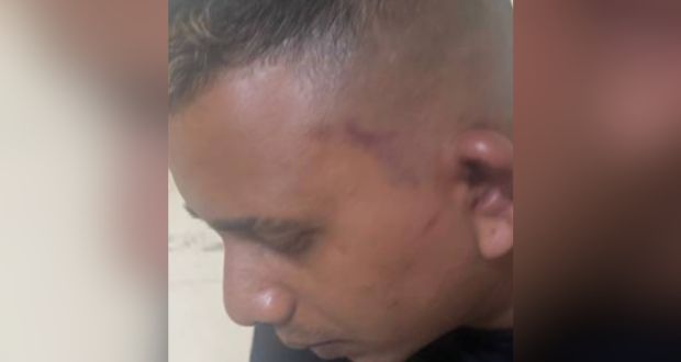 Incidents de Palmar : Le suspect Keerpah demande sa remise en liberté            