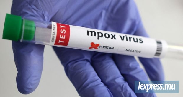 Un deuxième cas local de Mpox confirmé