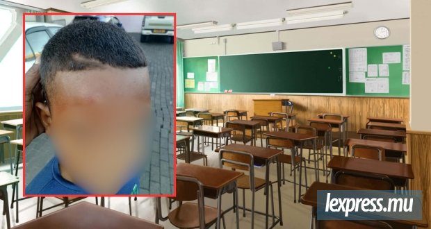 Un élève de dix ans accuse son enseignant de l’avoir giflé et poussé contre un mur