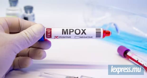 Un premier cas local de Mpox enregistré