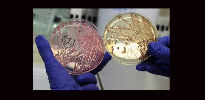 Allemagne : La bactérie E. coli progresse moins mais l''enquête piétine