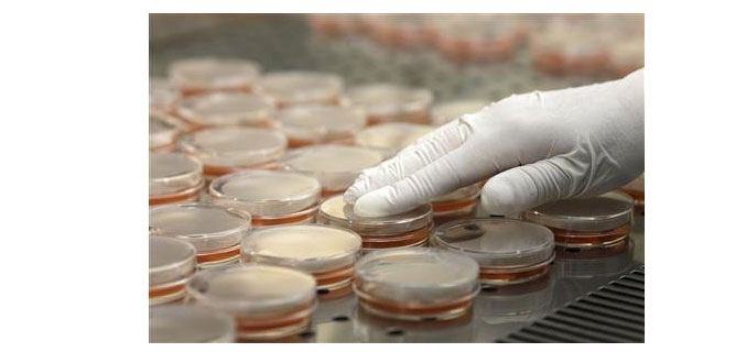 Le bilan de l''épidémie de bactérie E. coli porté à 30 morts