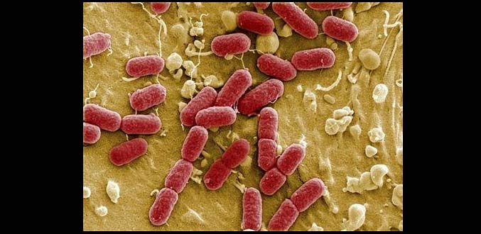 La souche d''E. coli à Bordeaux est la même qu''en Allemagne