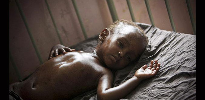 Somalie: les chiffres «effroyables» de la mortalité infantile