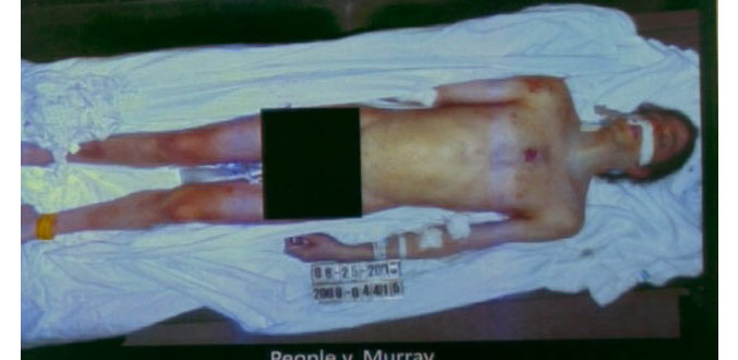 La télé américaine diffuse une photo de MJ sur la table d’autopsie