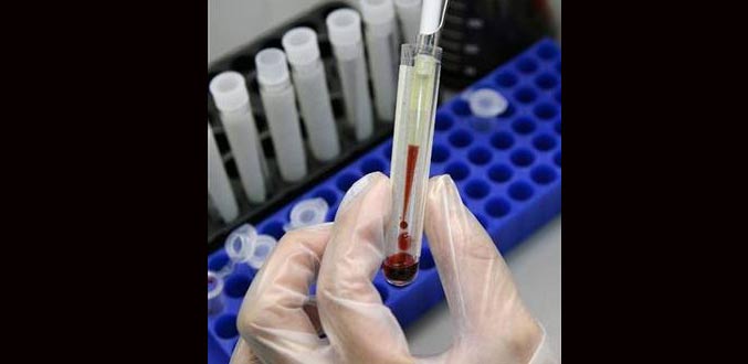 Un traitement préventif contre le Sida autorisé aux Etats-Unis