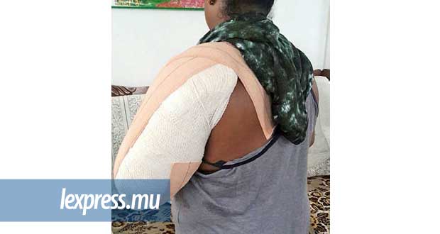 Tranquebar: il lui fracture l’épaule en volant sa chaîne