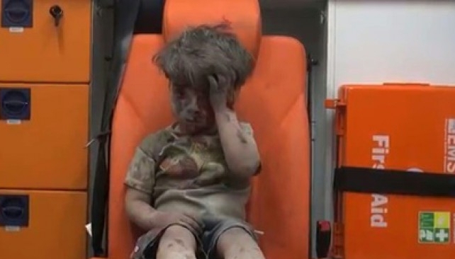 ​​​​​​​Omrane, 4 ans, symbole de la violence aveugle de la guerre en Syrie