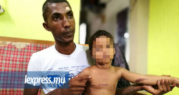 [Vidéo] Pailles: arrêtée pour avoir brûlé son petit-fils de trois ans