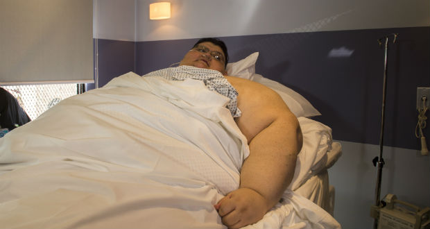 Un adulte sur cinq est obèse et cette tendance va s'aggraver, selon l'OCDE