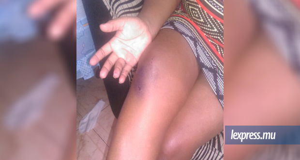 Victime de violence conjugale: elle poignarde son mari «pour se défendre»