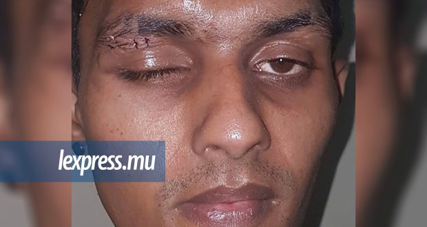 Plaine-Magnien: agressé après avoir interdit à un jeune de se… droguer 