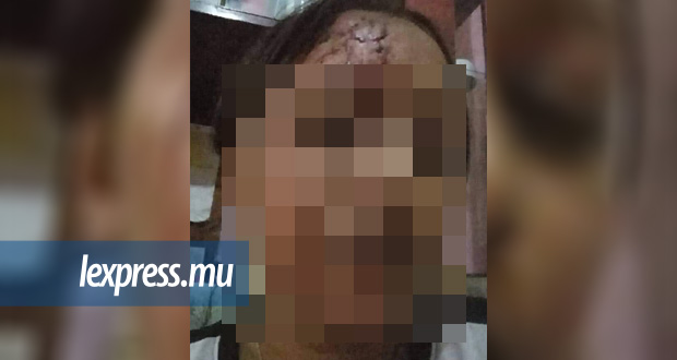Midlands: elle allègue avoir été agressée par le gendre de son voisin 