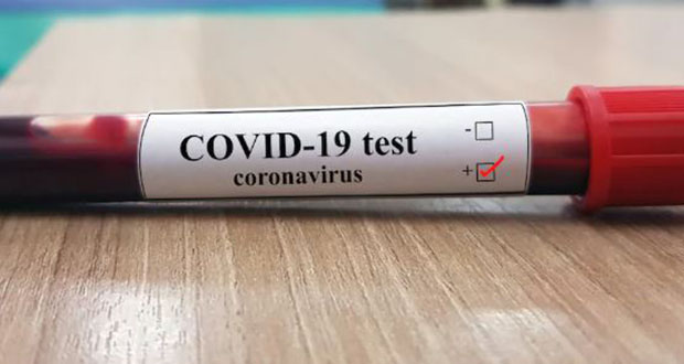 L'Asie centrale aux prises avec une deuxième vague de coronavirus