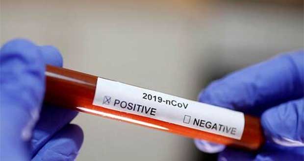 Covid-19: 156 décès attribués au virus depuis mars dernier