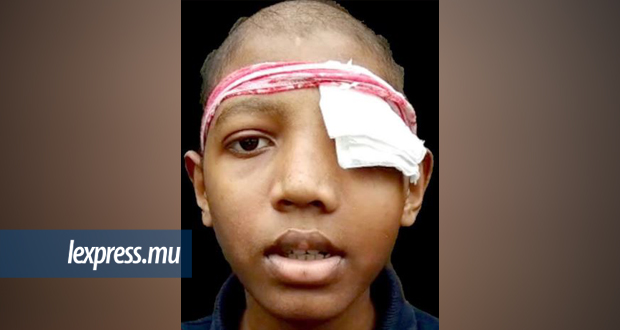 Atteint d’une tumeur: Leysh, 14 ans, la bataille d’une vie