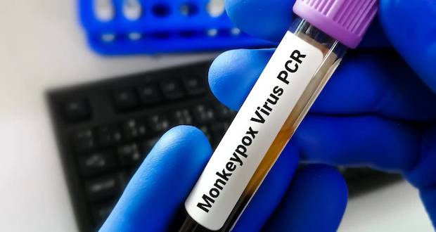 Variole du singe: 1 000 doses de vaccins commandées par les autorités