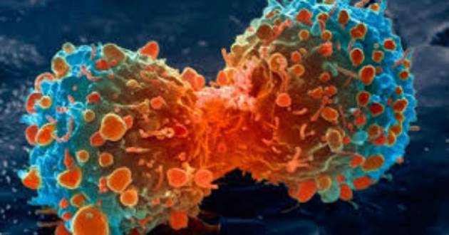 Cancer: mieux connaître la maladie pour faire avancer la recherche